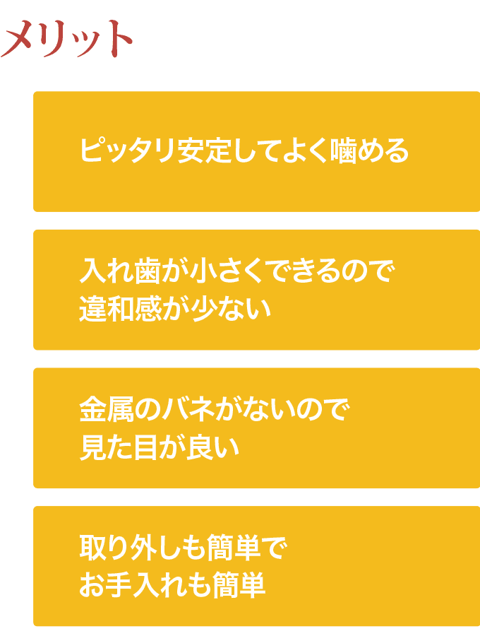 マグネット入れ歯_メリット_モバイル