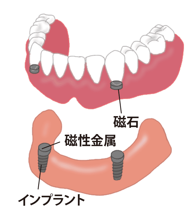 磁性金属